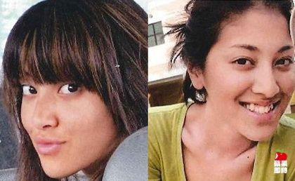 19岁时的陈凯琳皮肤黑，还有龅牙。