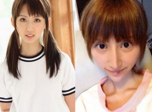 七濑里菜整容成大眼锥子脸