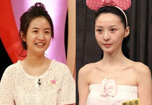 女神卸妆变屌丝 李艾普通小志老婆脸歪