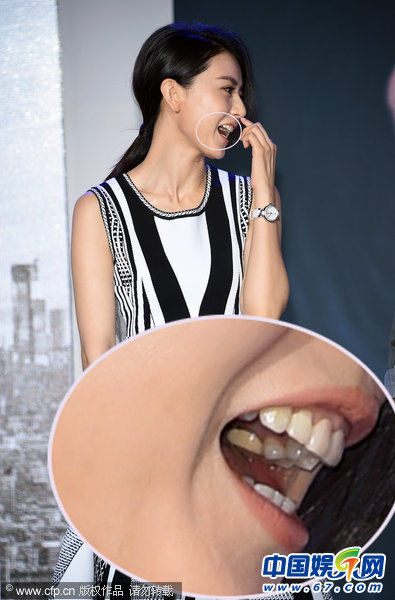 高圆圆双下巴明显颈纹大爆发 露内衣肩带走光