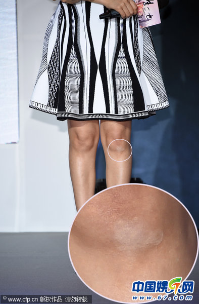 高圆圆双下巴明显颈纹大爆发 露内衣肩带走光