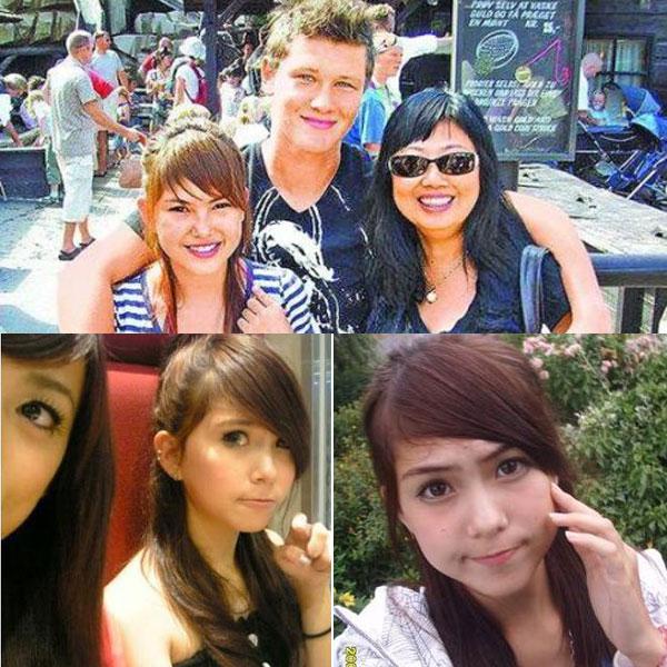 昆凌昔日综艺秀鼻塌脸肿似变脸 图揭明星整容失败僵脸