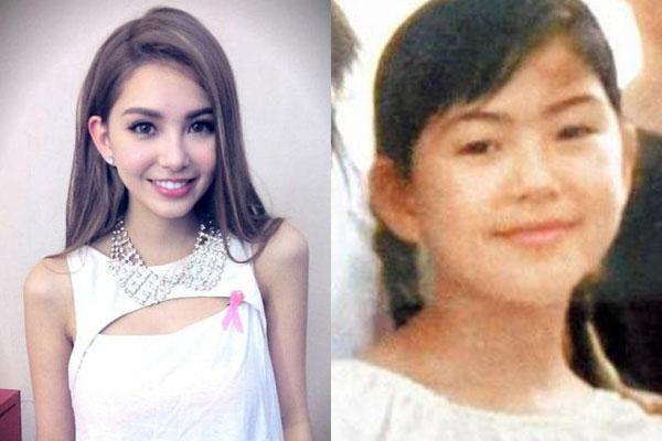 昆凌昔日综艺秀鼻塌脸肿似变脸 图揭明星整容失败僵脸