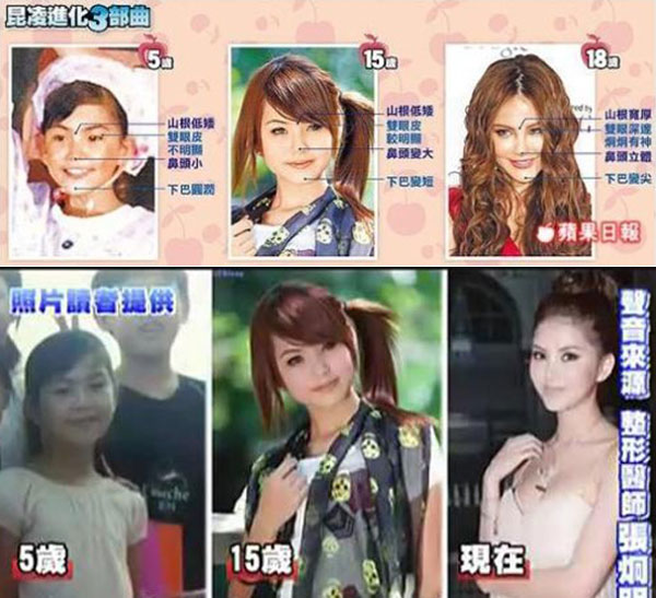 昆凌昔日综艺秀鼻塌脸肿似变脸 图揭明星整容失败僵脸