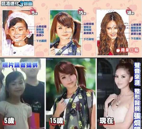 昆凌昔日综艺秀鼻塌脸肿似变脸 图揭明星整容失败僵脸