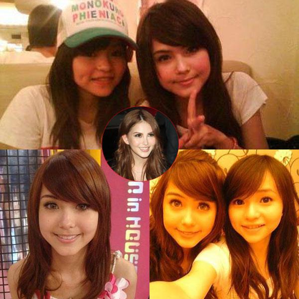 昆凌昔日综艺秀鼻塌脸肿似变脸 图揭明星整容失败僵脸