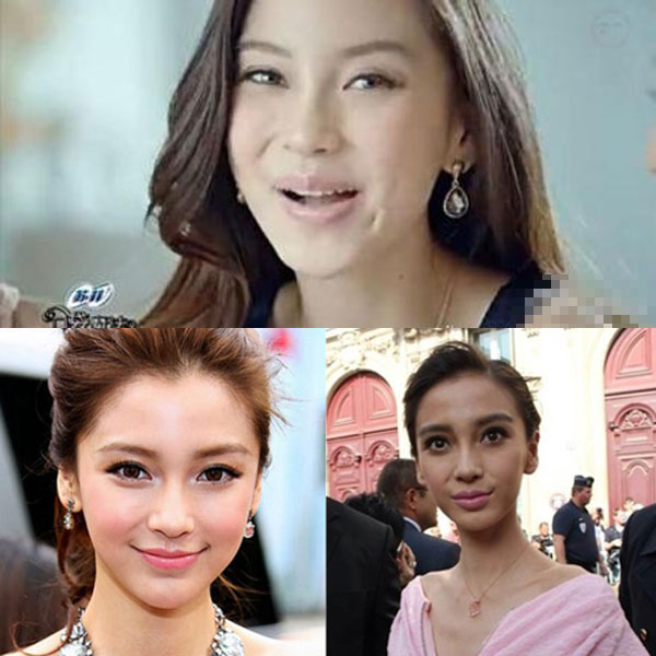 昆凌昔日综艺秀鼻塌脸肿似变脸 图揭明星整容失败僵脸