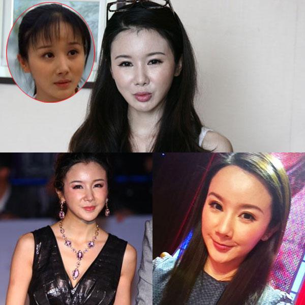 昆凌昔日综艺秀鼻塌脸肿似变脸 图揭明星整容失败僵脸