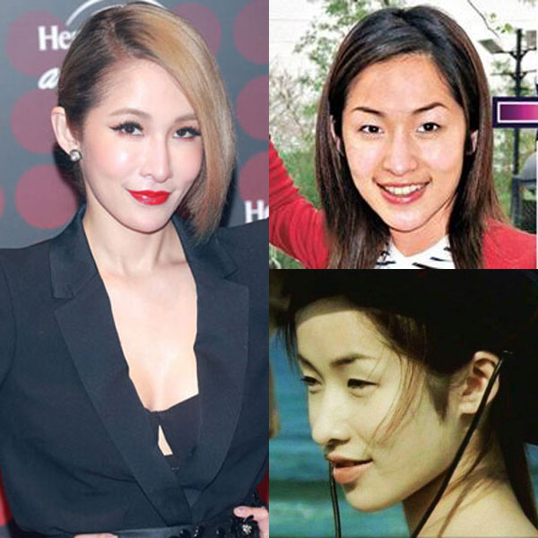 昆凌昔日综艺秀鼻塌脸肿似变脸 图揭明星整容失败僵脸