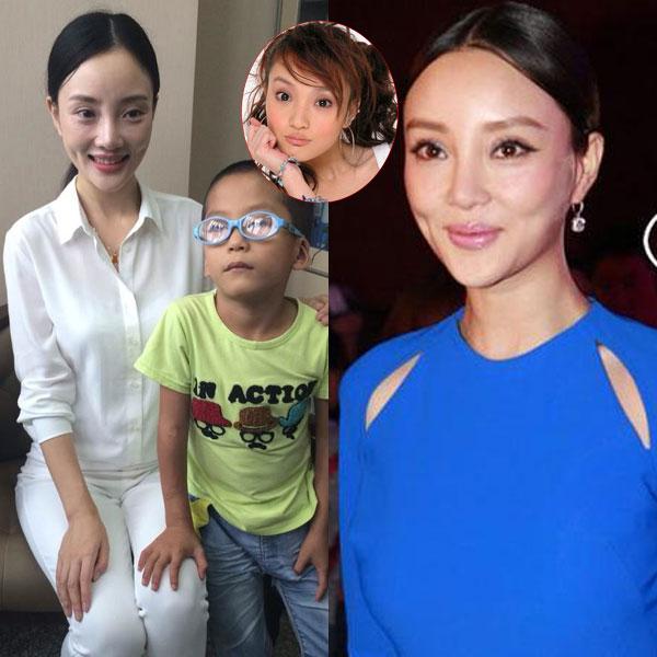 昆凌昔日综艺秀鼻塌脸肿似变脸 图揭明星整容失败僵脸