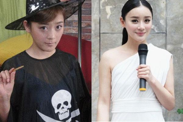 昆凌昔日综艺秀鼻塌脸肿似变脸 图揭明星整容失败僵脸