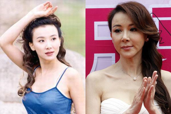 昆凌昔日综艺秀鼻塌脸肿似变脸 图揭明星整容失败僵脸