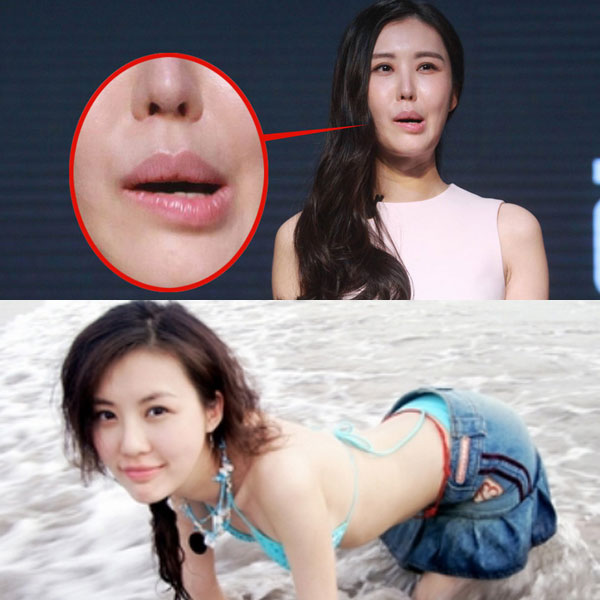 昆凌昔日综艺秀鼻塌脸肿似变脸 图揭明星整容失败僵脸