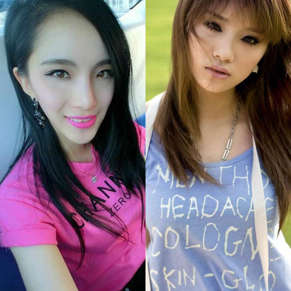 昆凌昔日综艺秀鼻塌脸肿似变脸 图揭明星整容失败僵脸