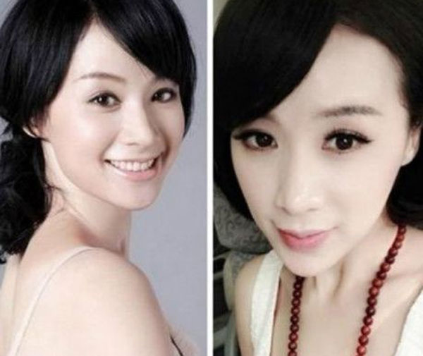 昆凌昔日综艺秀鼻塌脸肿似变脸 图揭明星整容失败僵脸