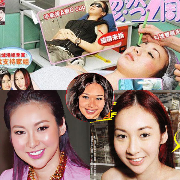 昆凌昔日综艺秀鼻塌脸肿似变脸 图揭明星整容失败僵脸