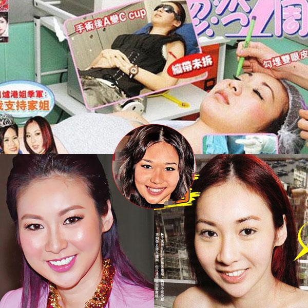 昆凌昔日综艺秀鼻塌脸肿似变脸 图揭明星整容失败僵脸