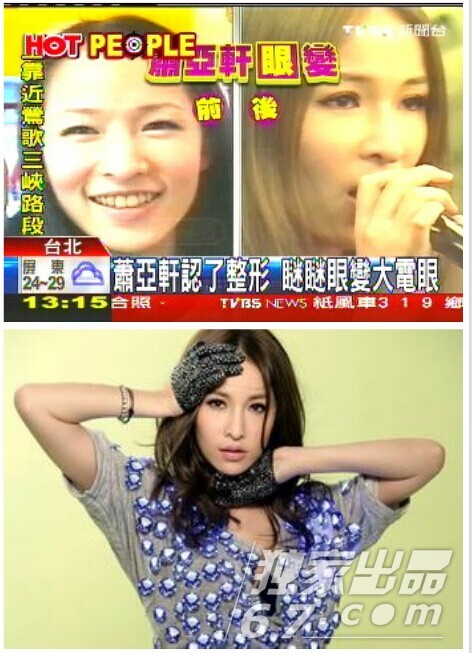 不少明星大胆承认自己整容的事实，来看下吧