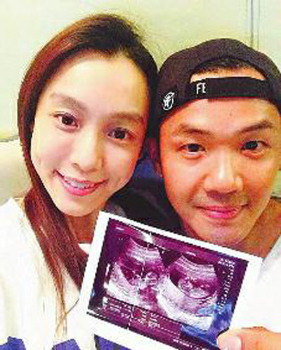 范玮琪晒自拍酒窝迷人 头发稀少惹粉丝心疼