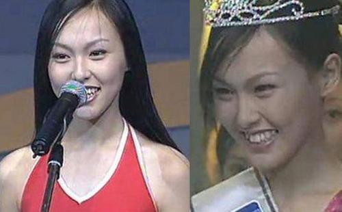 他们曾是龅牙！高圆圆周海媚一笑死 唐嫣牙烂如村婆