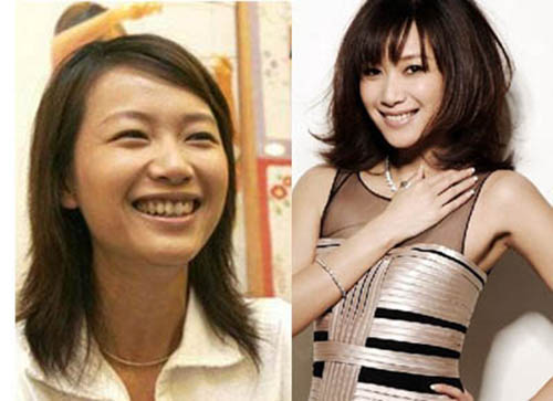 细数因“烂牙”变丑明星 高圆圆整完成女神