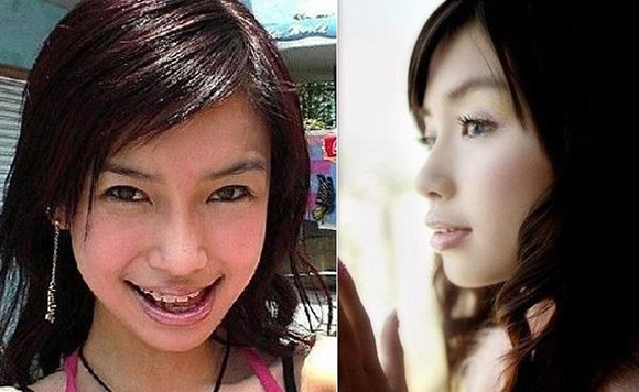 细数因“烂牙”变丑明星 高圆圆整完成女神