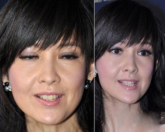 细数因“烂牙”变丑明星 高圆圆整完成女神