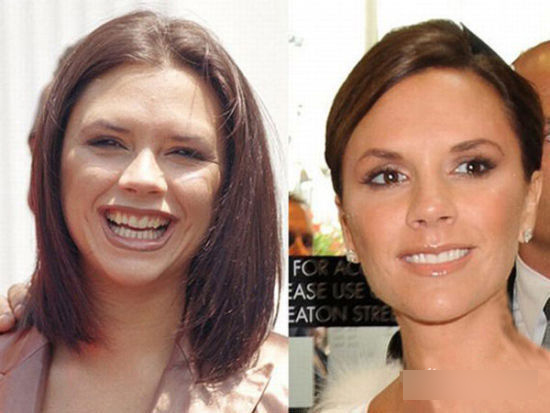 细数因“烂牙”变丑明星 高圆圆整完成女神