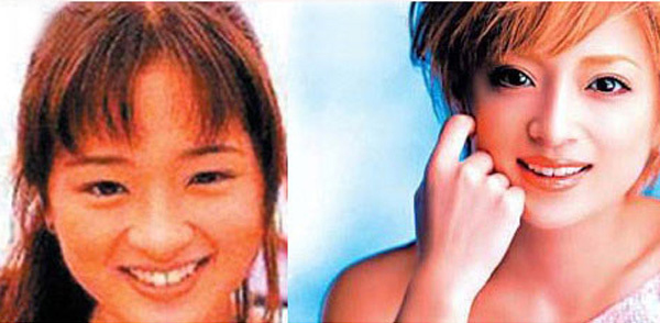 细数因“烂牙”变丑明星 高圆圆整完成女神