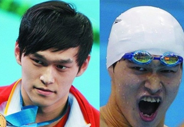 细数因“烂牙”变丑明星 高圆圆整完成女神