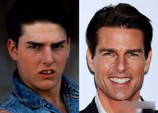 细数因“烂牙”变丑明星 高圆圆整完成女神