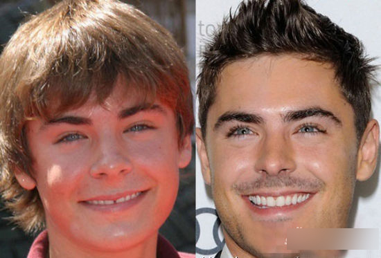 细数因“烂牙”变丑明星 高圆圆整完成女神