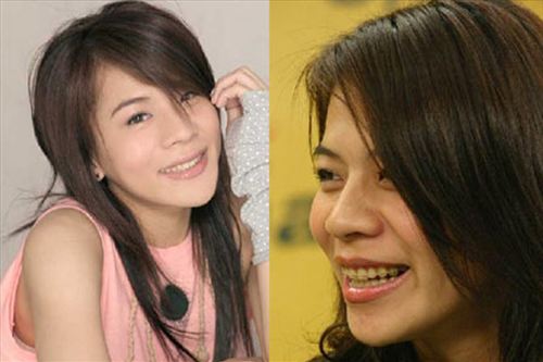 细数因“烂牙”变丑明星 高圆圆整完成女神