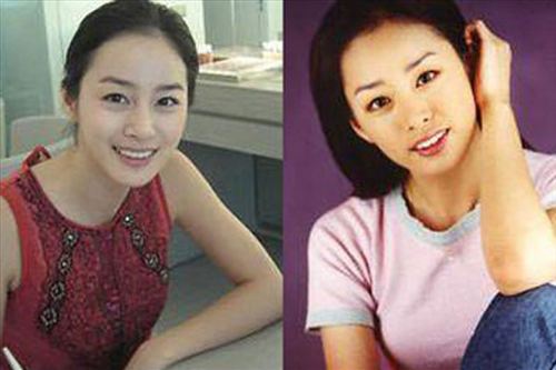 细数因“烂牙”变丑明星 高圆圆整完成女神