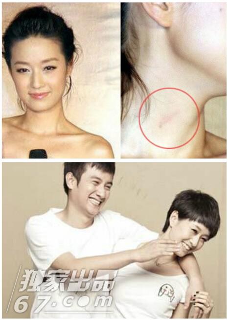 明星吻痕被拍尴尬瞬间