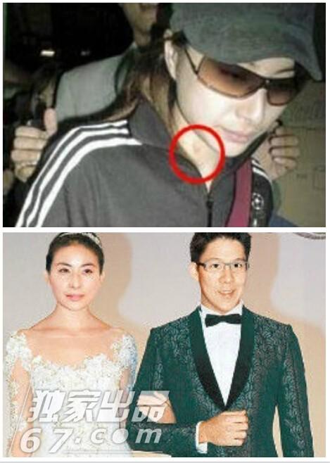 明星吻痕被拍尴尬瞬间