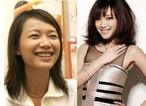 细数因牙齿变丑明星 女星几乎都整过牙