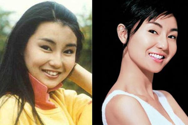 细数因牙齿变丑明星 女星几乎都整过牙