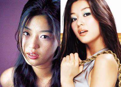 细数因牙齿变丑明星 女星几乎都整过牙