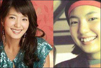 细数因牙齿变丑明星 女星几乎都整过牙