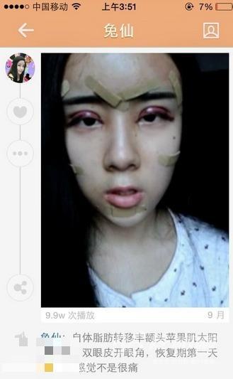 15岁萌少女整容变蛇精 高调炫富遭抨击