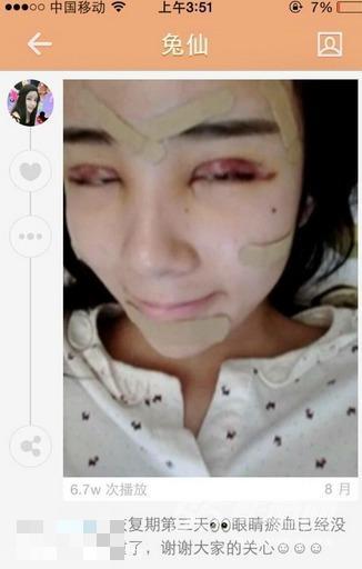 15岁萌少女整容变蛇精 高调炫富遭抨击