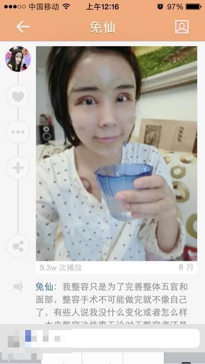 15岁萌少女整容变蛇精 高调炫富遭抨击