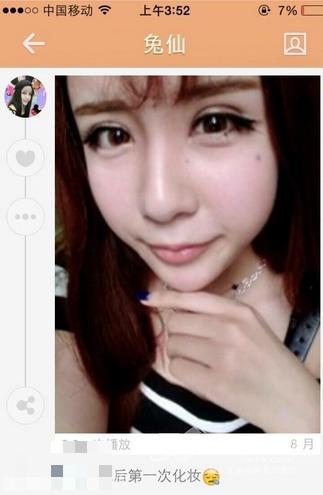 15岁萌少女整容变蛇精 高调炫富遭抨击