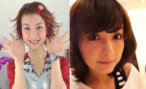 明星青涩照揭整容真相：熊黛林旧照吓跑郭富城