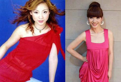 明星青涩照揭整容真相：熊黛林旧照吓跑郭富城