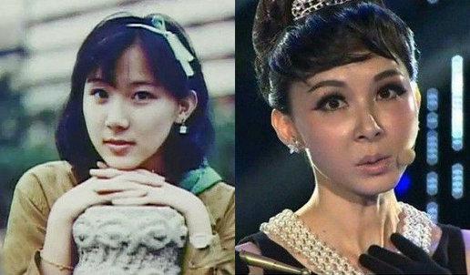 明星青涩照揭整容真相：熊黛林旧照吓跑郭富城