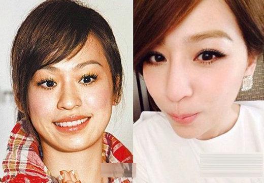 明星青涩照揭整容真相：熊黛林旧照吓跑郭富城