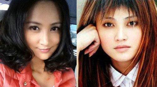 明星青涩照揭整容真相：熊黛林旧照吓跑郭富城