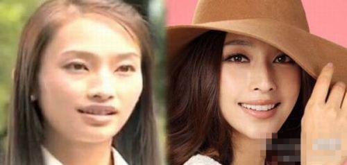 孙俪杨幂李小璐 女星出道前未整容雷人照吓死人